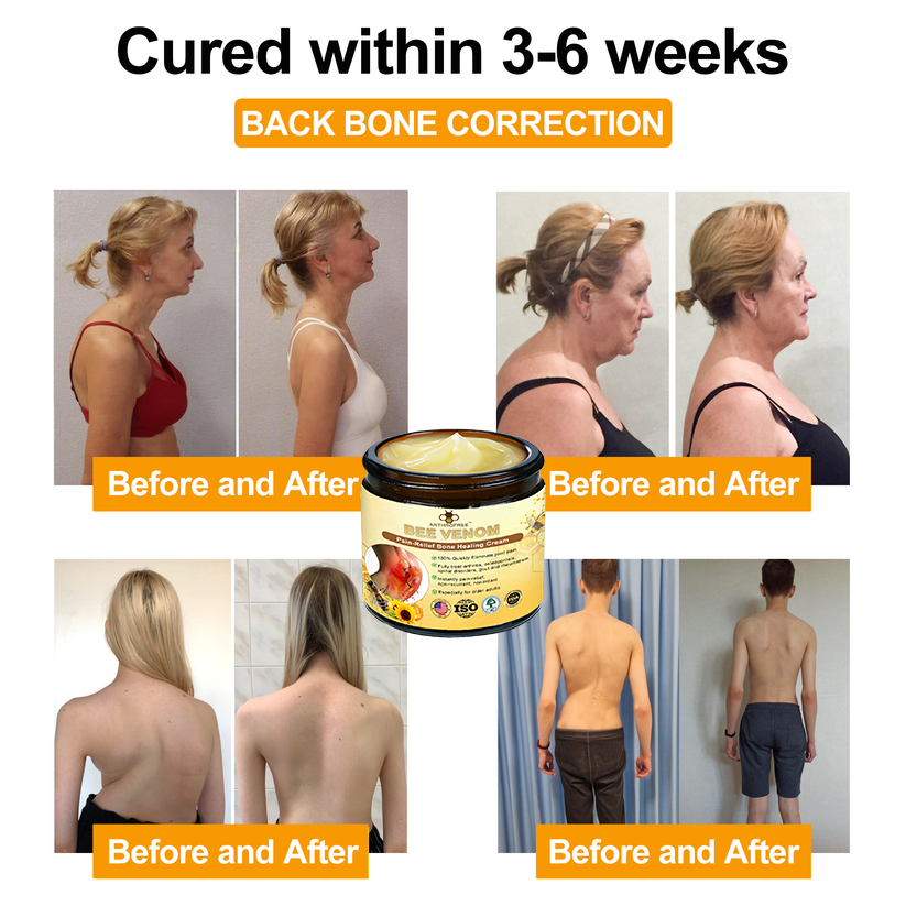 𝐀𝐫𝐭𝐡𝐫𝐨𝐅𝐫𝐞𝐞™ 𝐁𝐞𝐞 𝐕𝐞𝐧𝐨𝐦 𝐏𝐚𝐢𝐧 𝐑𝐞𝐥𝐢𝐞𝐟 𝐚𝐧𝐝 𝐁𝐨𝐧𝐞 𝐇𝐞𝐚𝐥𝐢𝐧𝐠 𝐂𝐫𝐞𝐚𝐦 (𝐄𝐬𝐩𝐞𝐜𝐢𝐚𝐥𝐥𝐲 𝐒𝐮𝐢𝐭𝐚𝐛𝐥𝐞 𝐟𝐨𝐫 𝐒𝐞𝐧𝐢𝐨𝐫𝐬, 𝐀𝐀𝐎𝐒 𝐑𝐞𝐜𝐨𝐦𝐦𝐞𝐧𝐝𝐞𝐝)